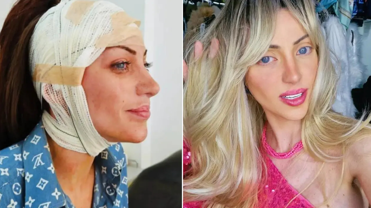 barbie bebege benzemek icin 27 kez ameliyat oldu brezilyali fenomen 31 yasinda hayatini kaybetti Fm9cch9h.jpg